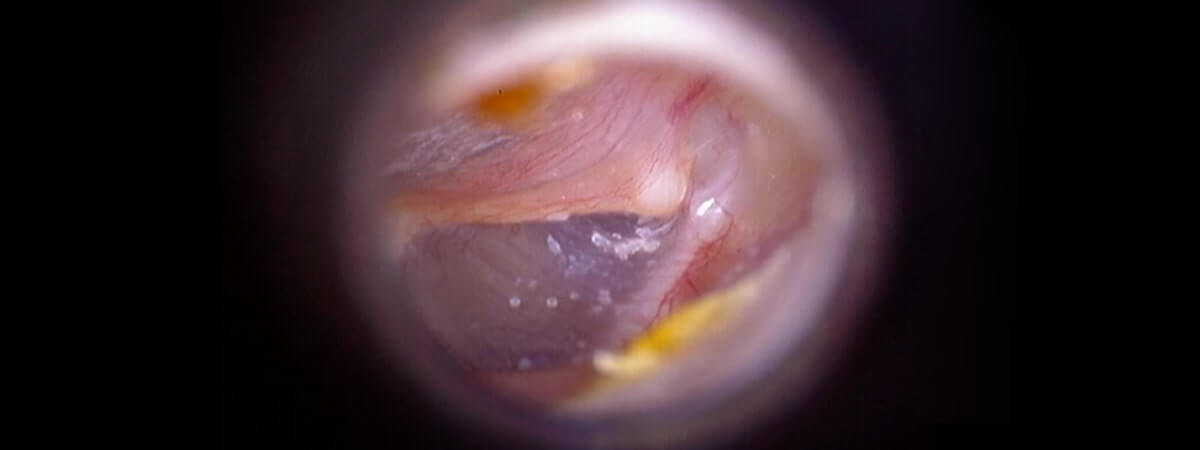 Advanced Imaging Technology-before-Taevas-endoscope